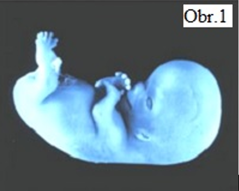 Embryonální vývoj postavení nohy